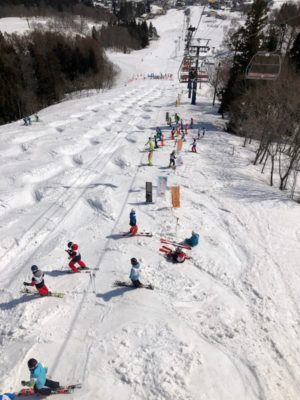 戸狩温泉スキー場のモーグルバーン